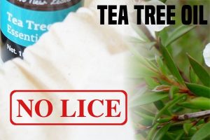 Tea Tree Oil For Lice